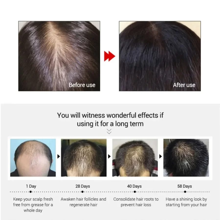 Anti-Hair Loss Oil (AHLO-01)